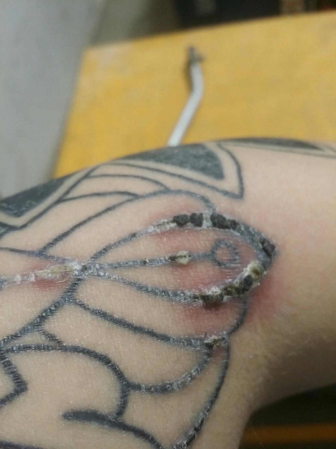 Tattoo Scabbing peeling off the scabs  YouTube