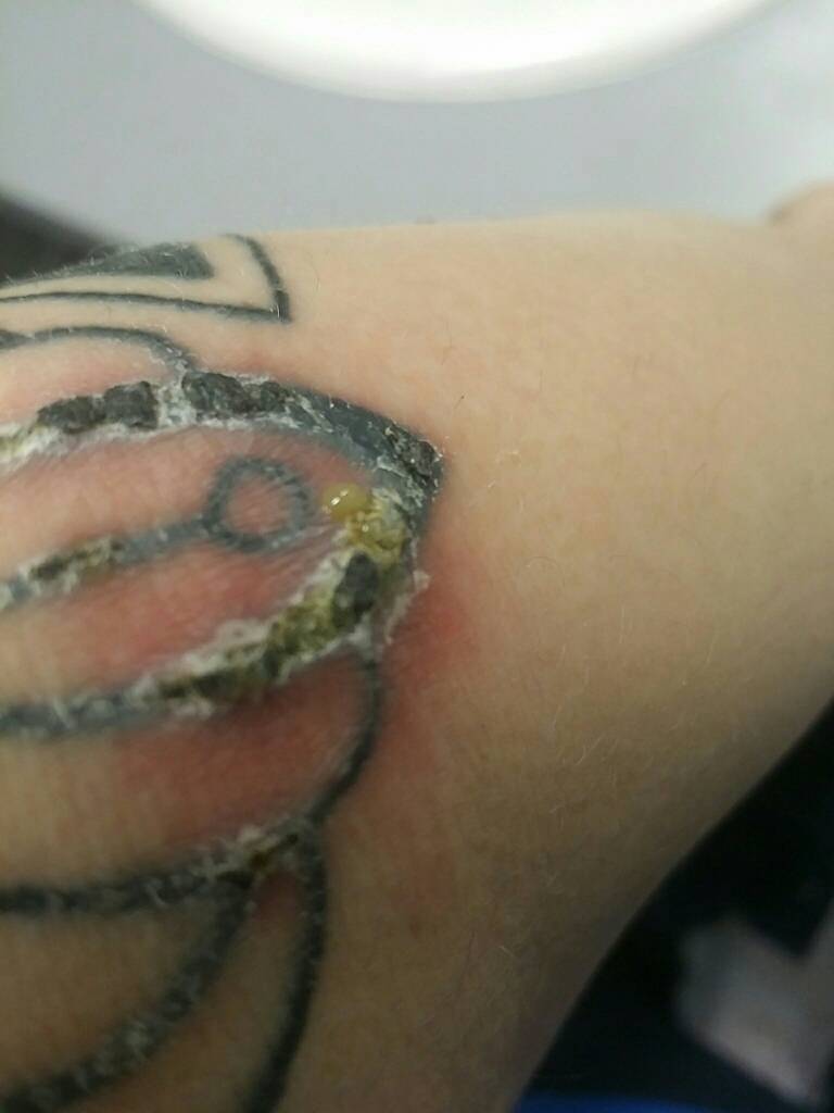 Healed elbow. | Tattoos, Unique tattoos, Tattoo designs