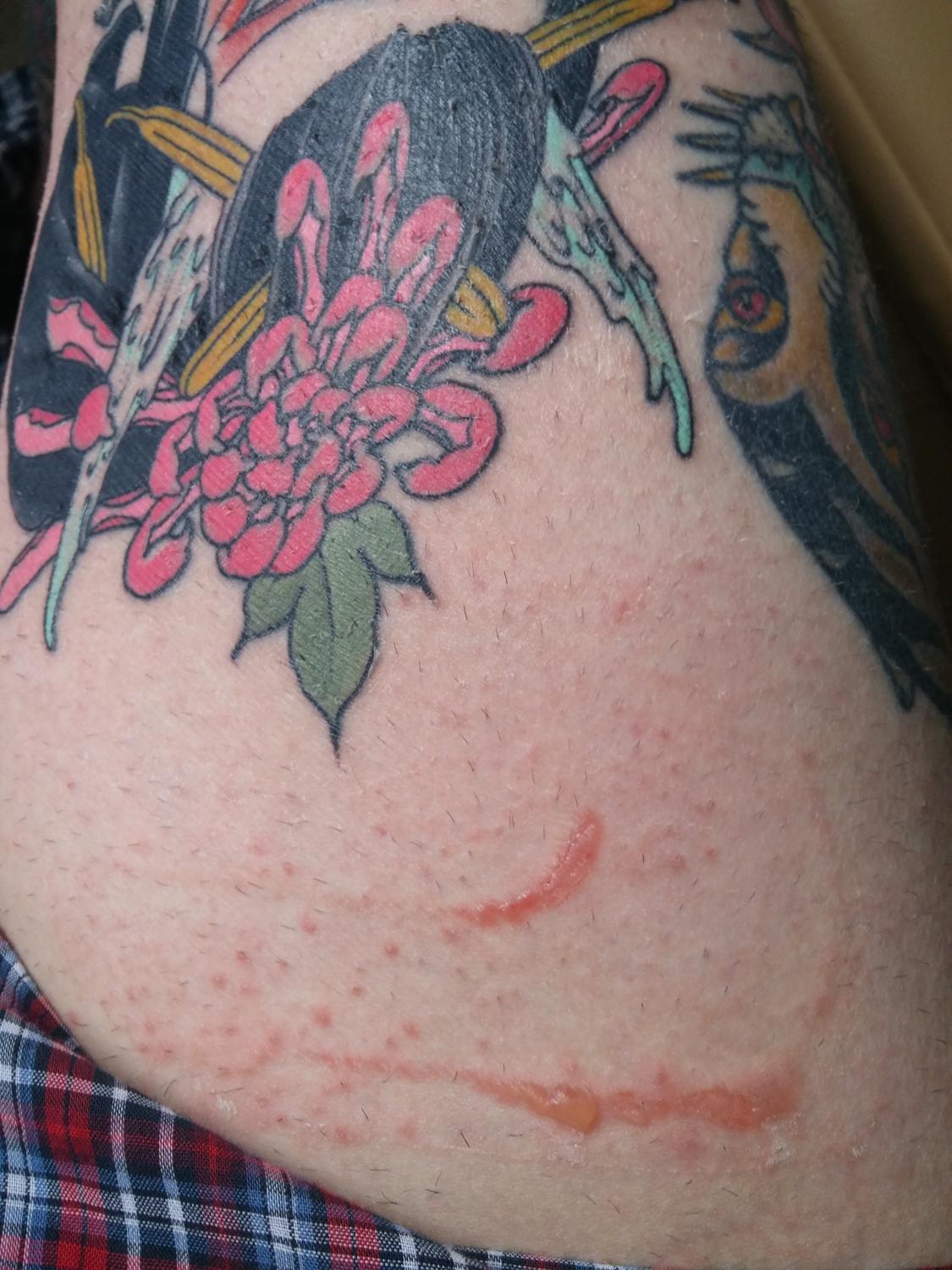 Saniderm Tattoo Ink Bleeding Wiki Tattoo