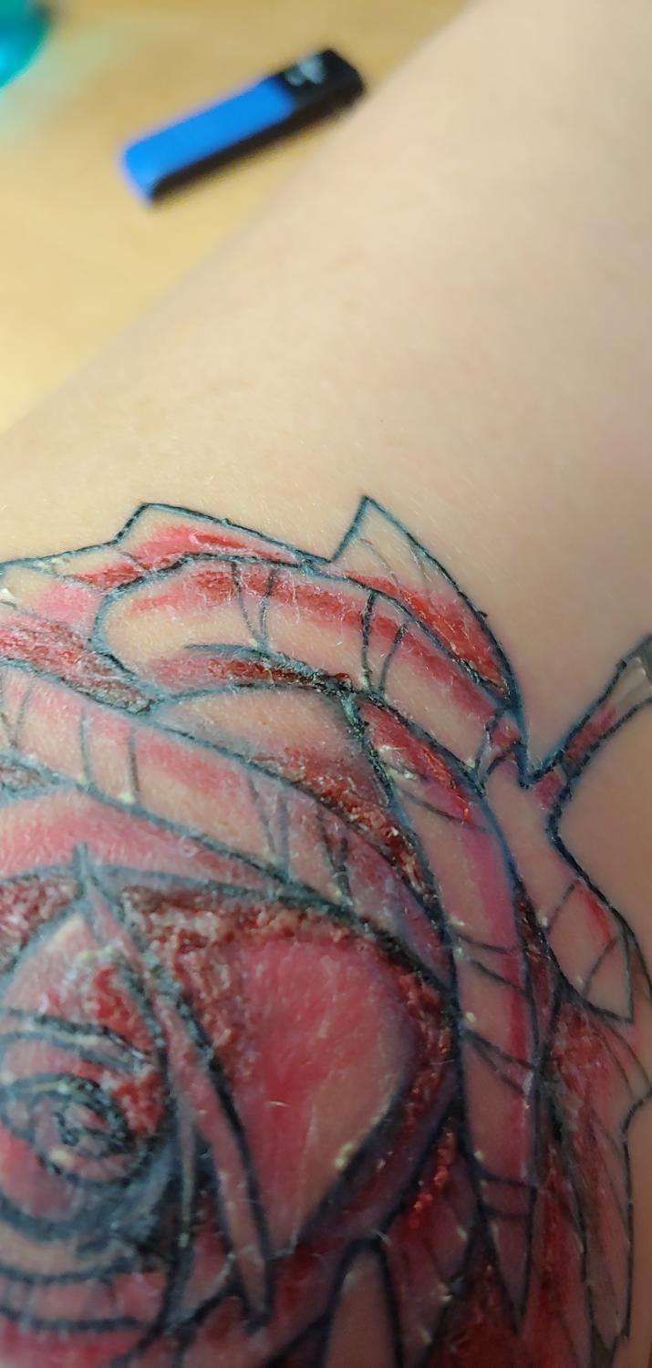 Red Tattoo Ink Why Its Prone to Itchiness and How to Help