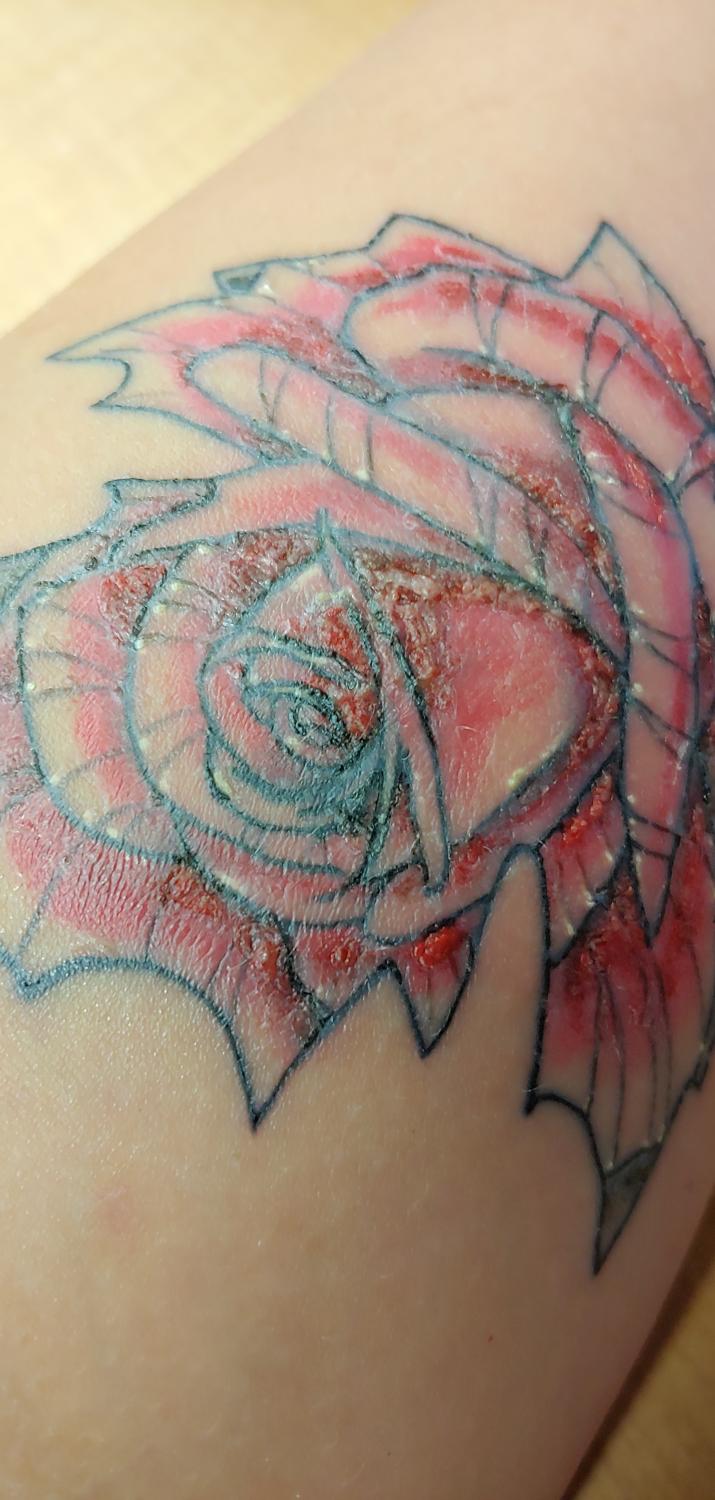Recovery time from darker red ink Got this tattoo finished 3 12 months  ago Everything is healing fine except the darker red color You can see in  photo the skin is raised