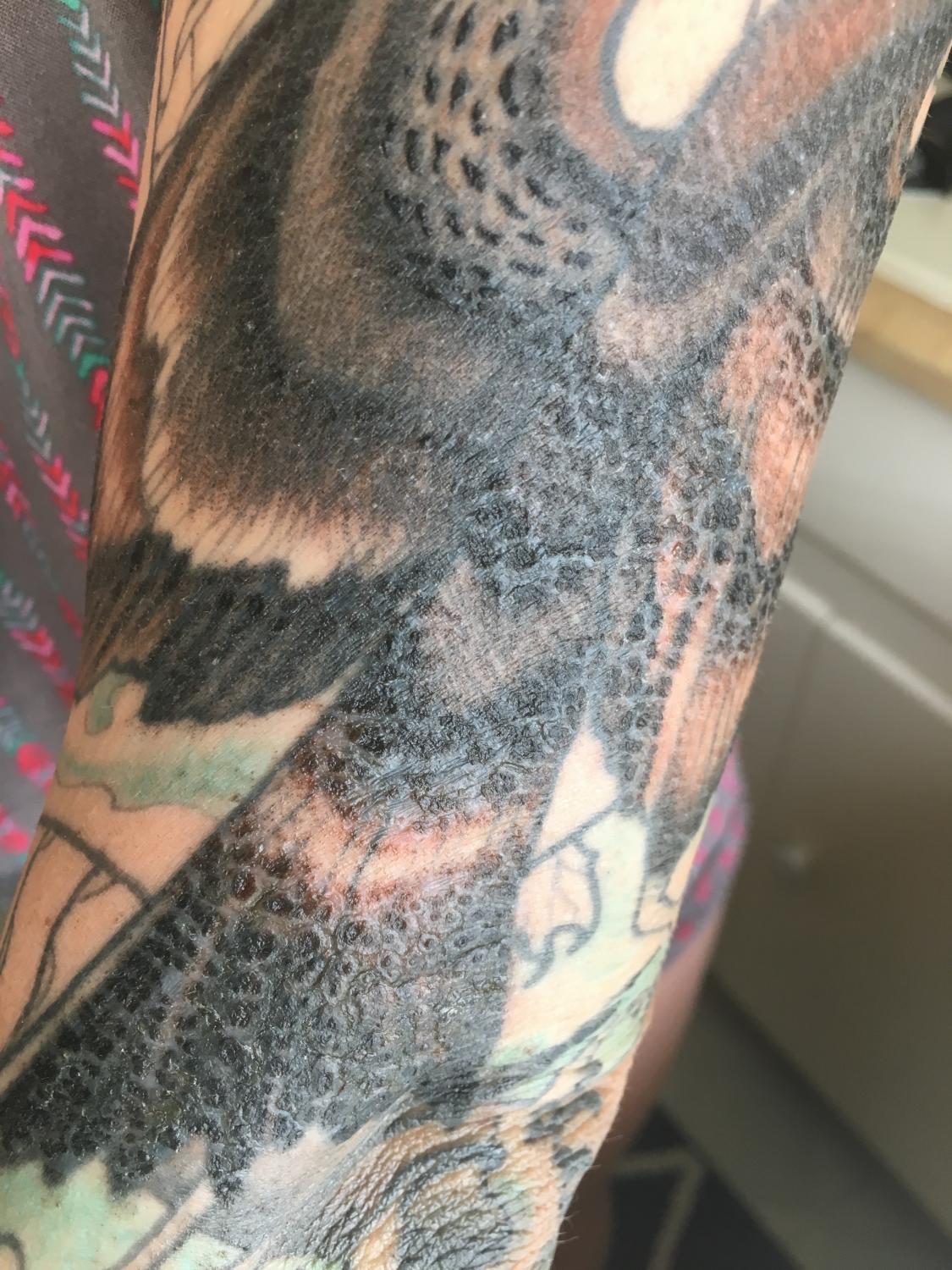 Should You Be Concerned If Your New Tattoo Is Leaking Fluid