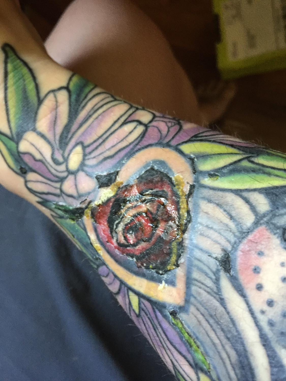can i let my tattoo dry heal