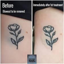Tattoo Blowout or Healing How to Tell if Your Tattoo is Messed Up   Tattooing 101